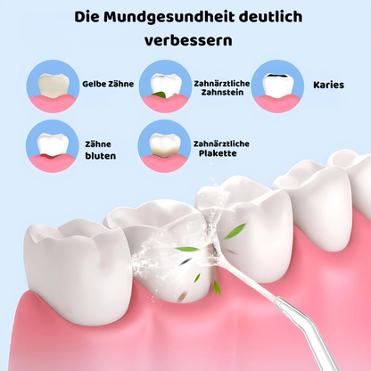 Elektrischer Oral Irrigator für Frische Zahnreinigung
