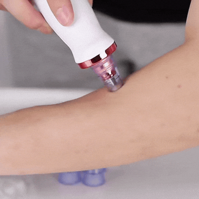 Gesichtsreiniger mit Vakuum – Porenreinigung & Hautpflege Gerät
